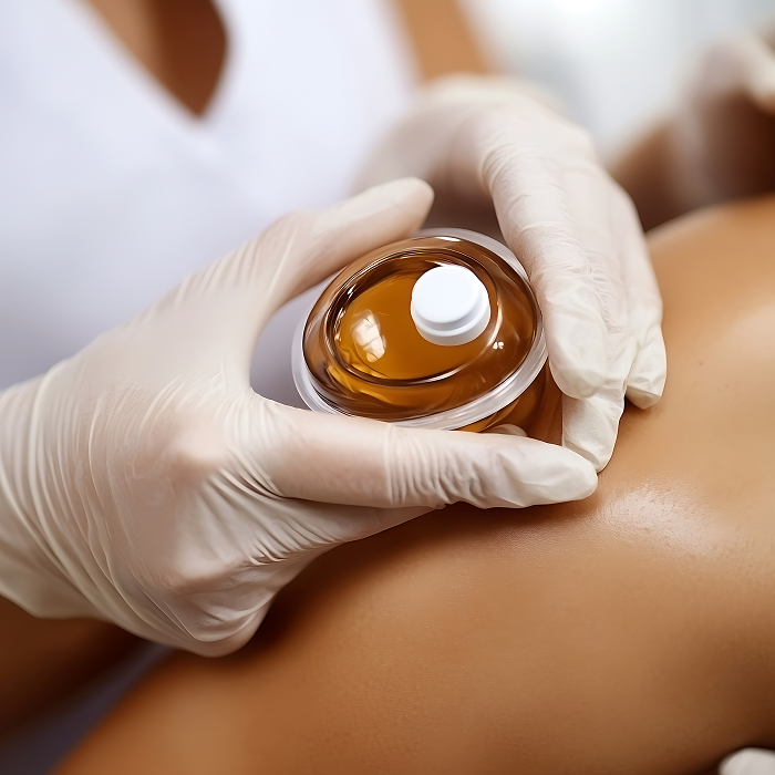 Баночный массаж